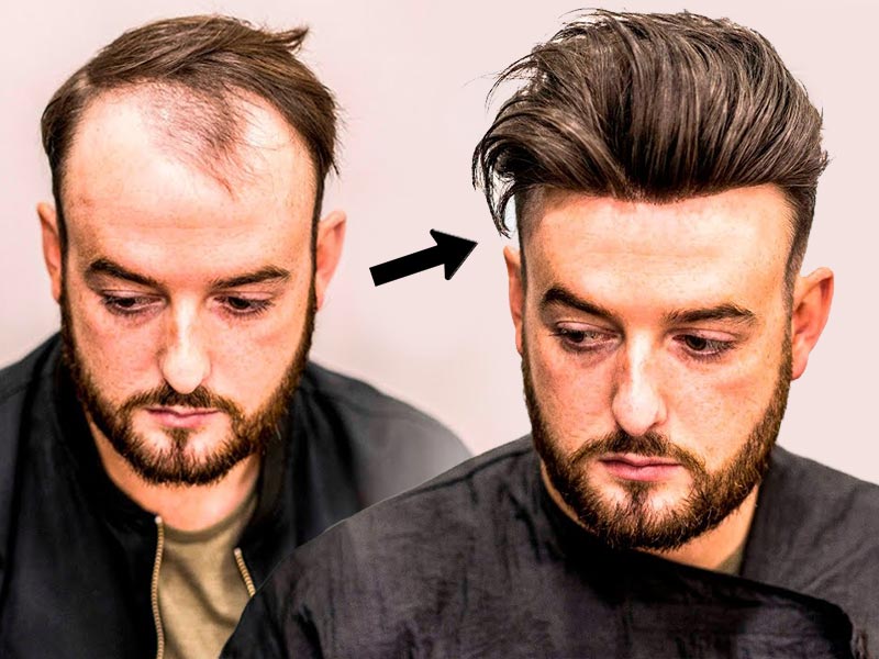 The Ultimate Guide On How To Make A Toupee DIY | Lewigs