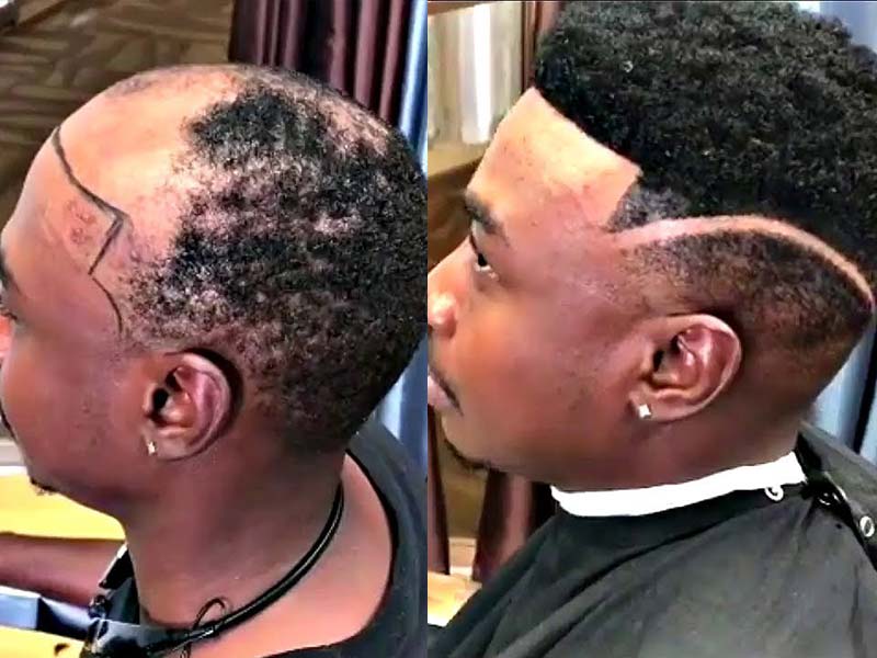Afro Toupee For The Black - Are You Prepared For A Good Thing?