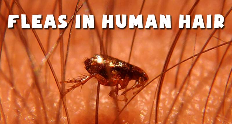 Fleas In Human Hair Symptoms & How To Stop This Menace