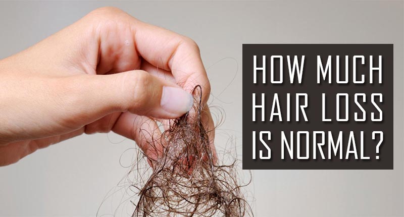 How Much Hair Loss Is Normal? - These Statistics Are Real!