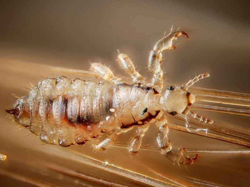 How To Tell If You Have Lice: Pay Attention To These 5 Signals!