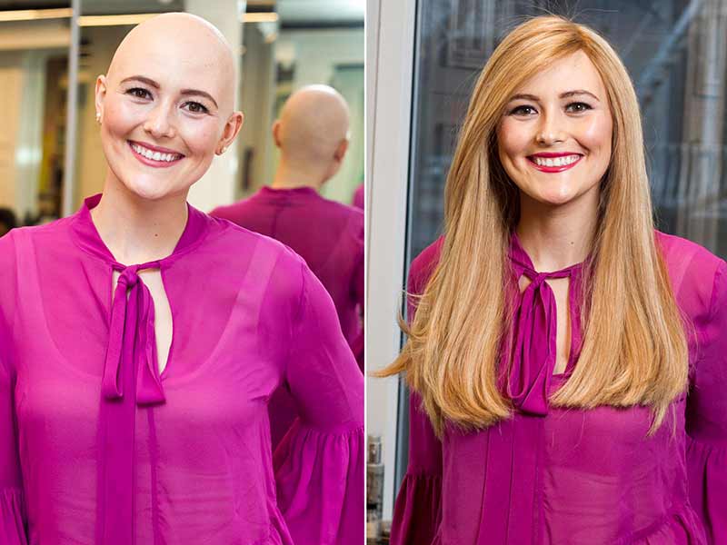 Wig For Chemo Patient - How To Choose It Right?